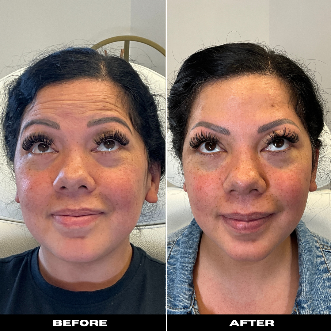 Before and After Image: Tox - front
