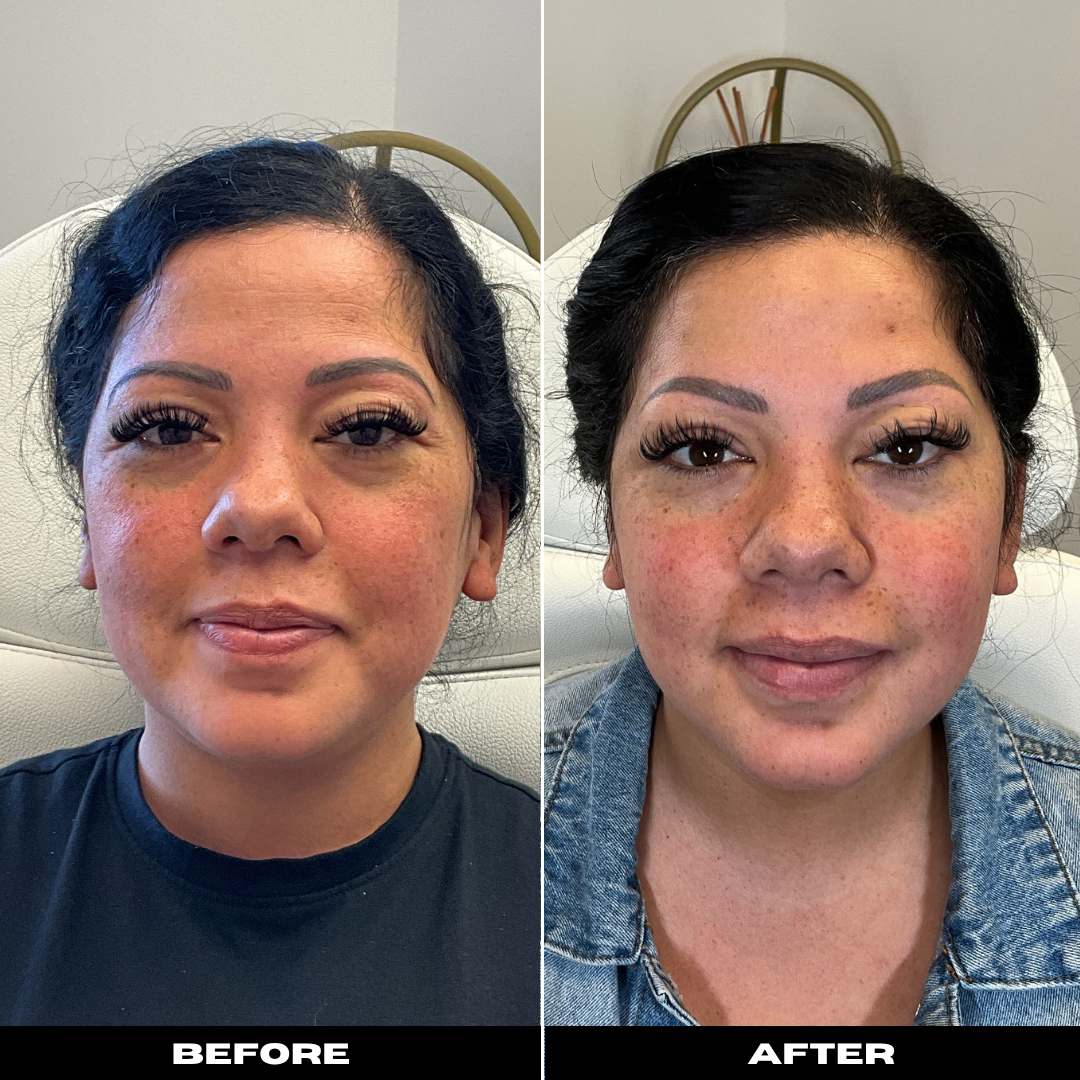Before and After Image: Tox - front