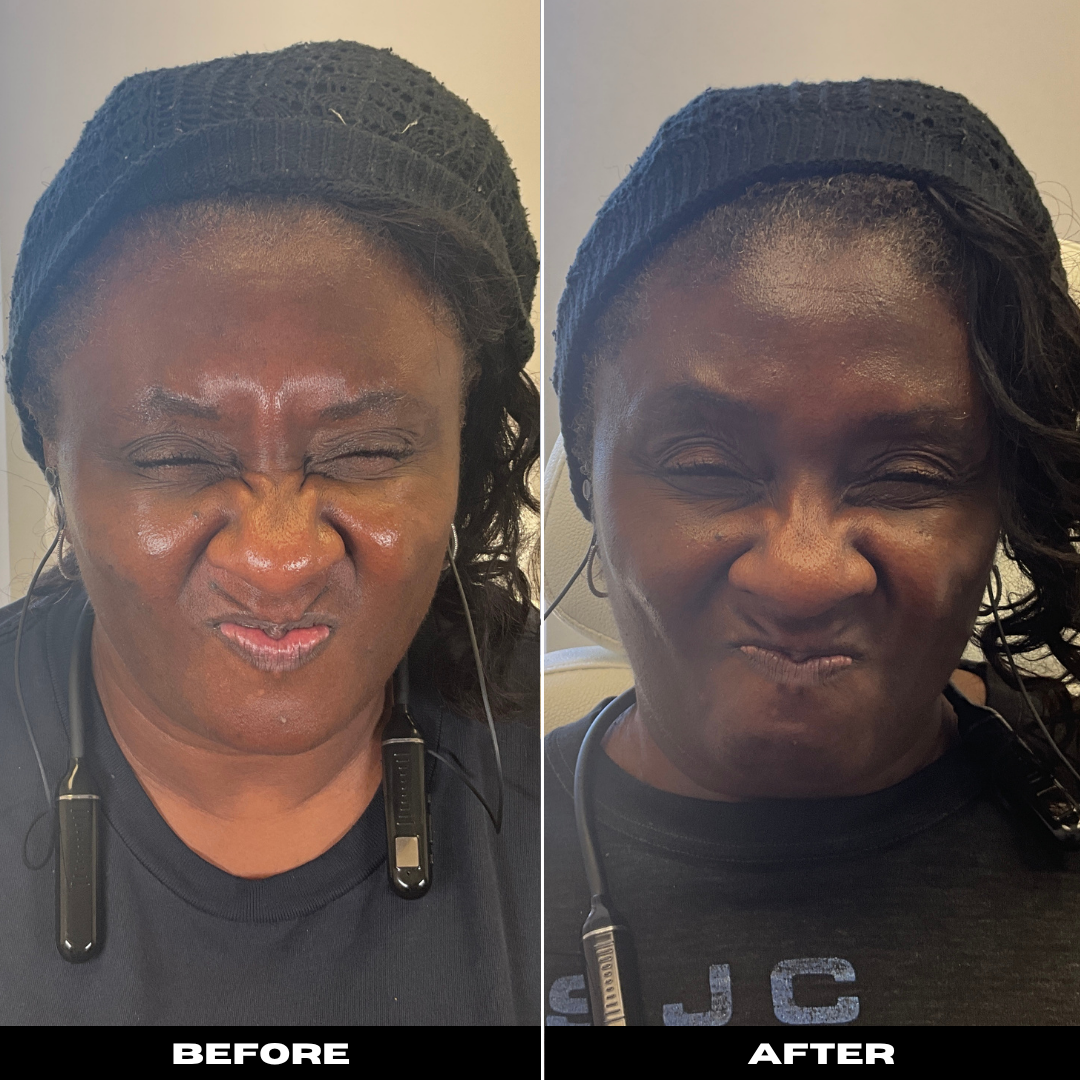 Before and After Image: Tox - front
