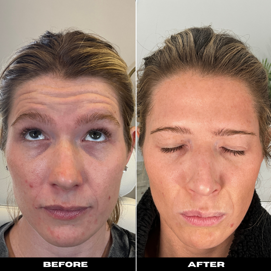 Before and After Image: Tox - front