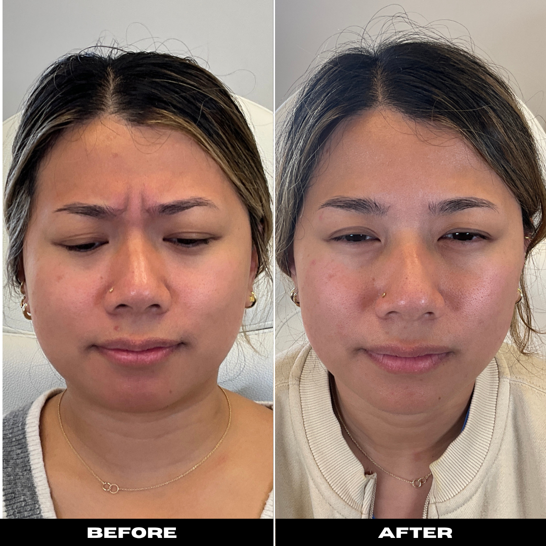 Before and After Image: Tox - front