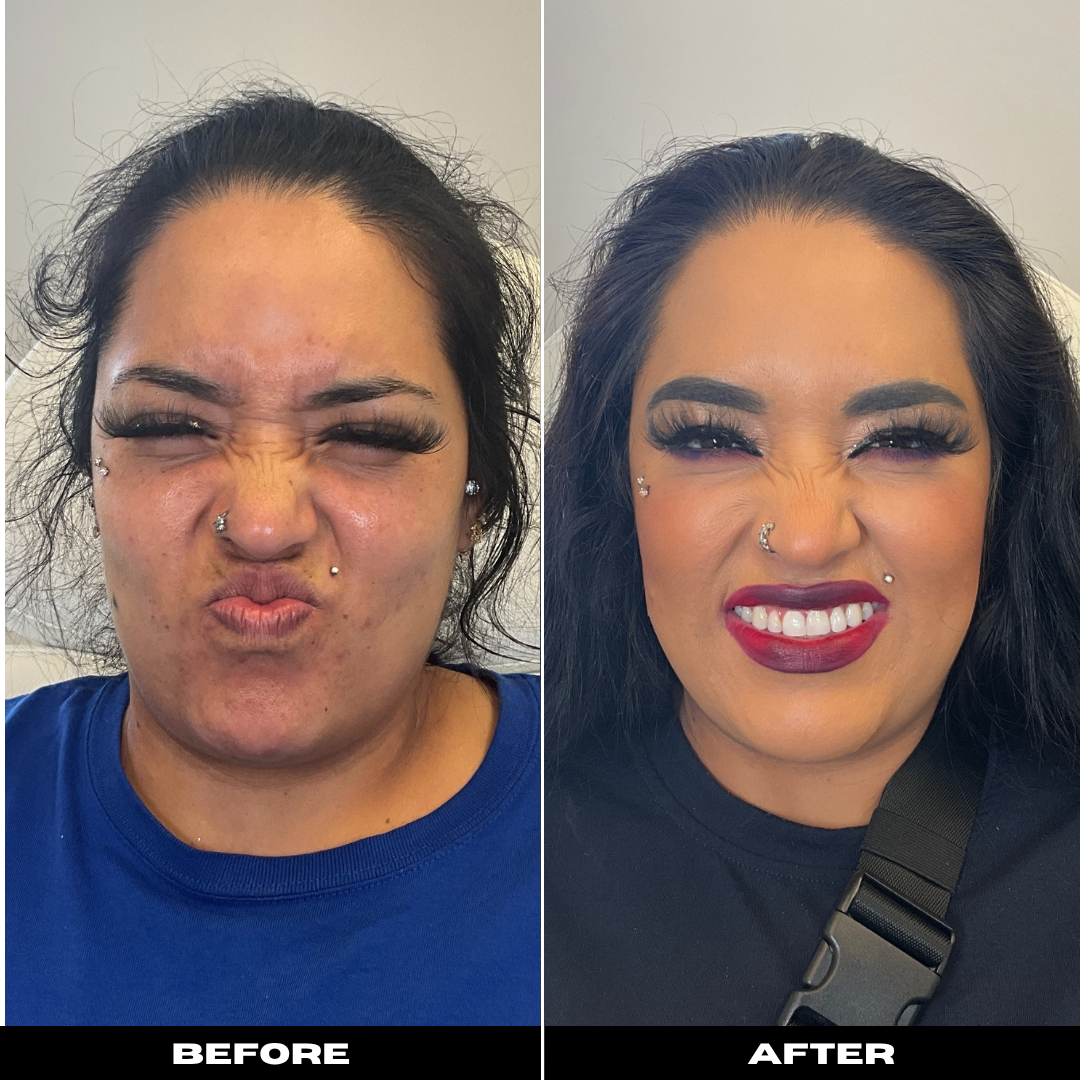 Before and After Image: Tox - front
