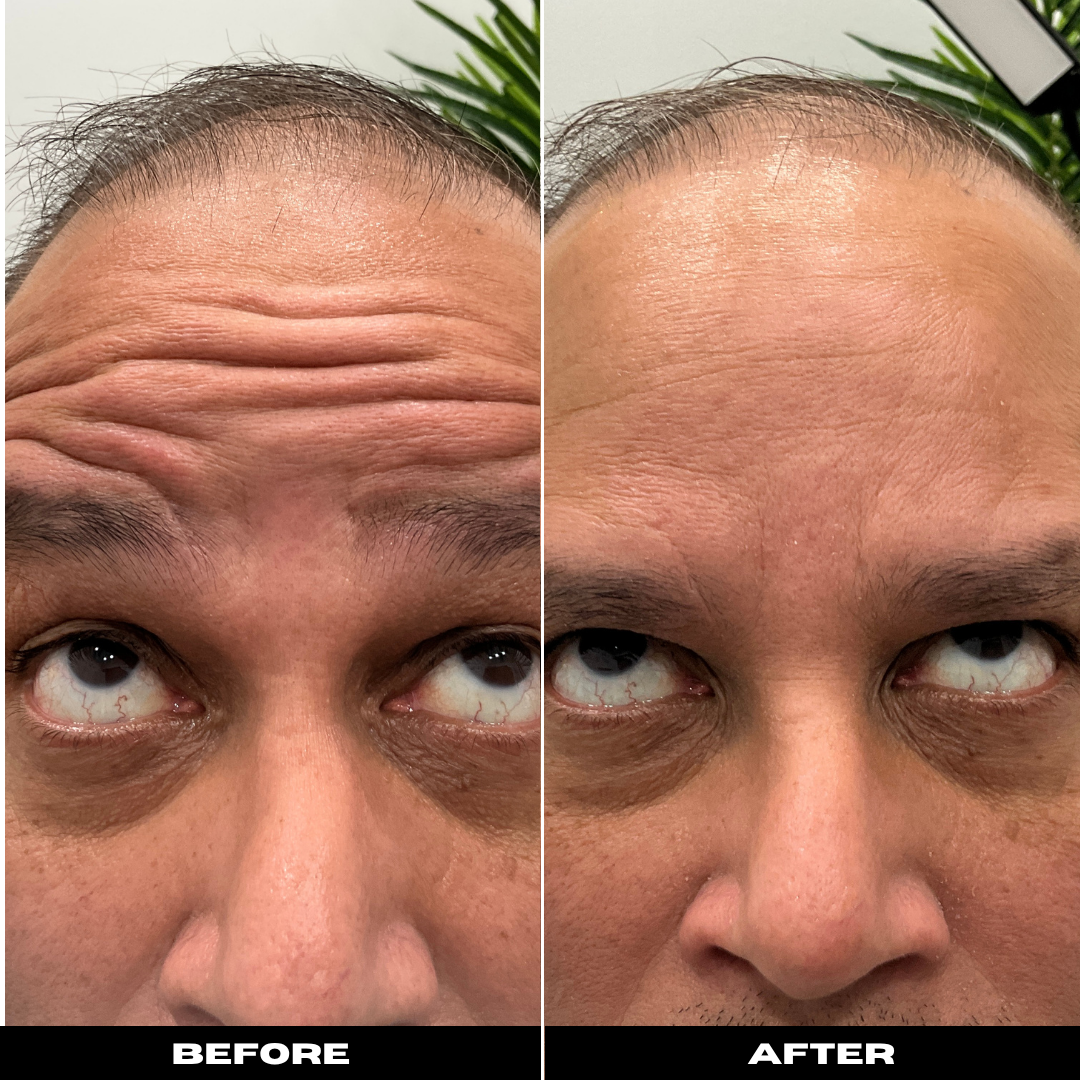 Before and After Image: Tox - front