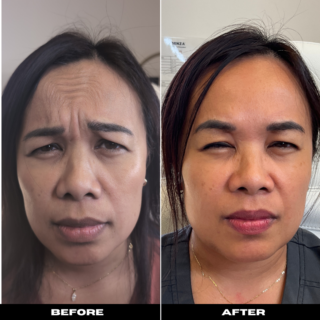 Before and After Image: Tox - front