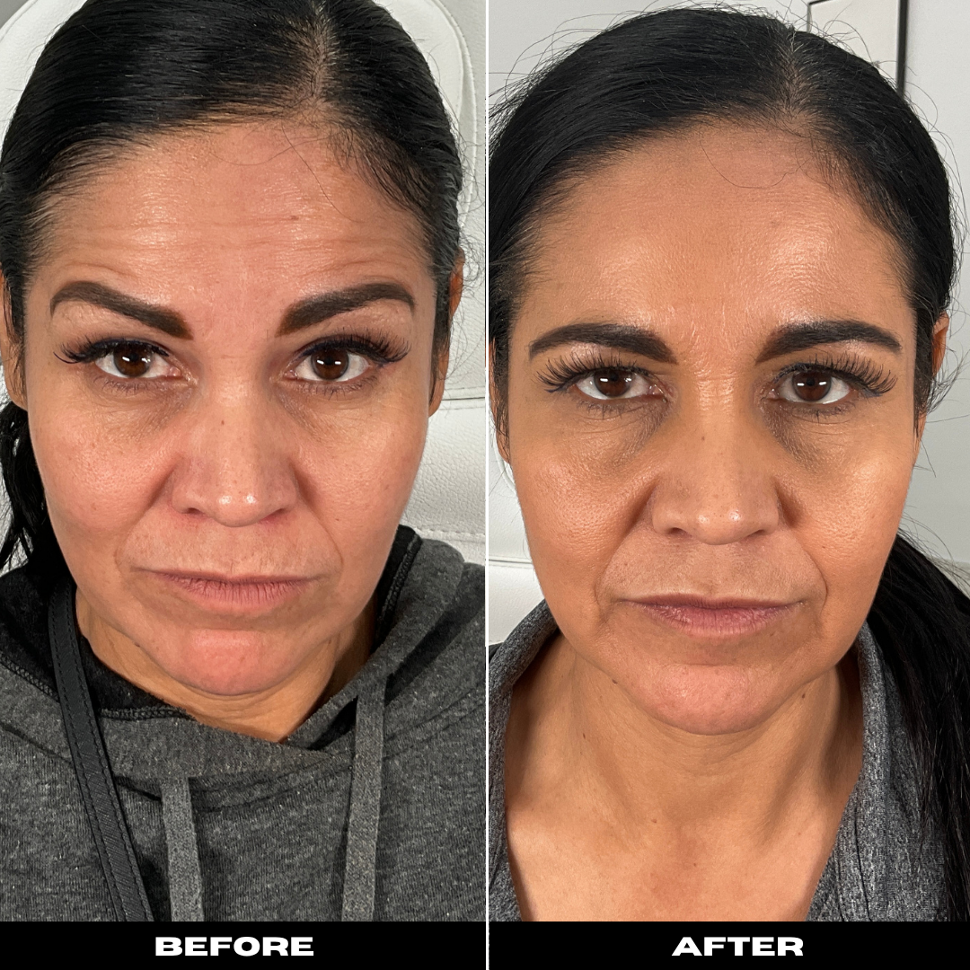 Before and After Image: Tox - front