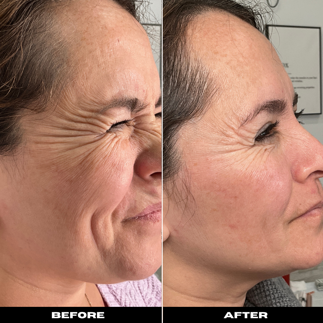 Before and After Image: Tox - right-front-oblique