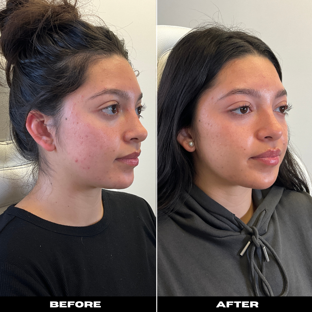 Before and After Image: Tox - right-front-oblique