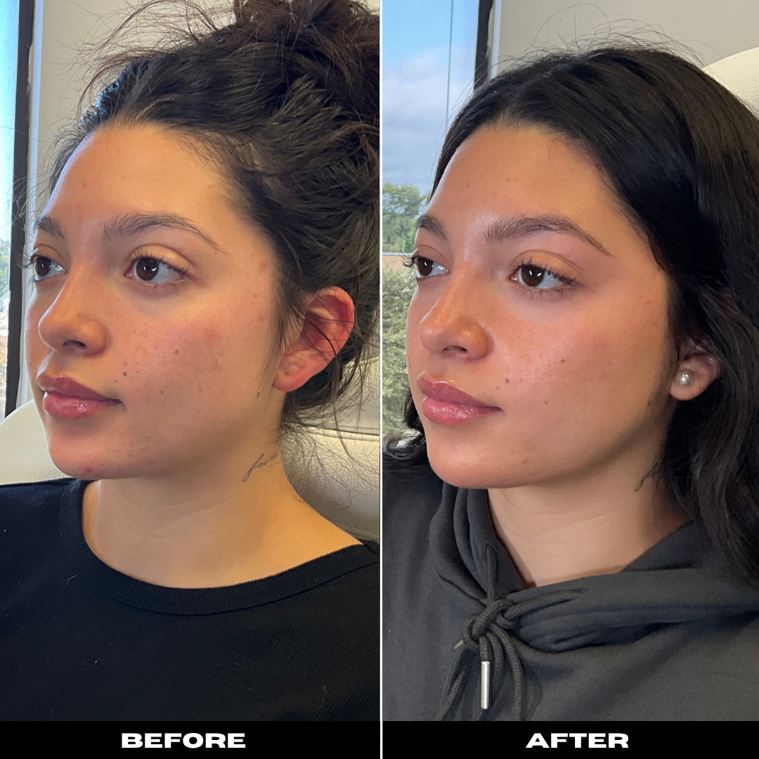 Before and After Image: Tox - left-front-oblique
