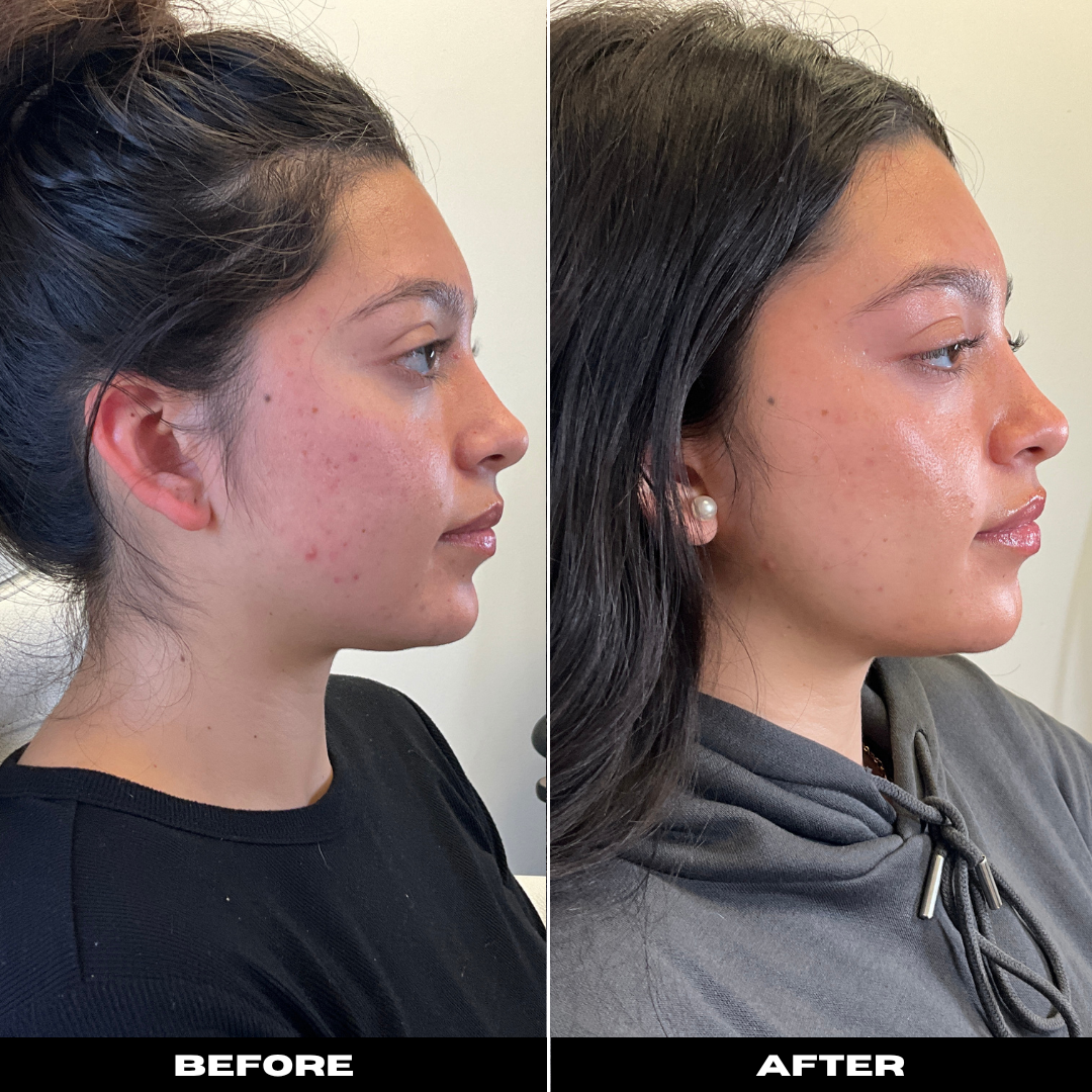 Before and After Image: Tox - right-side