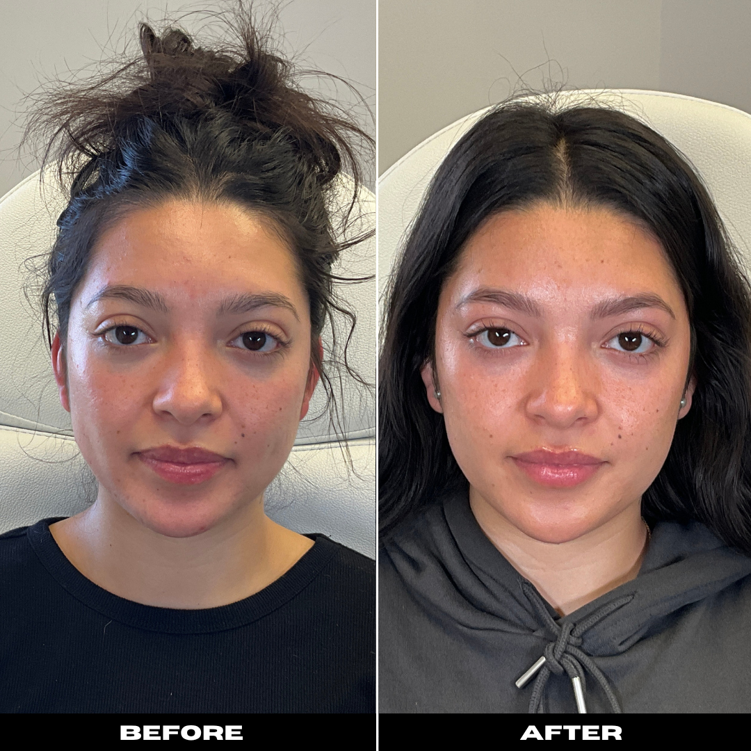 Before and After Image: Tox - front
