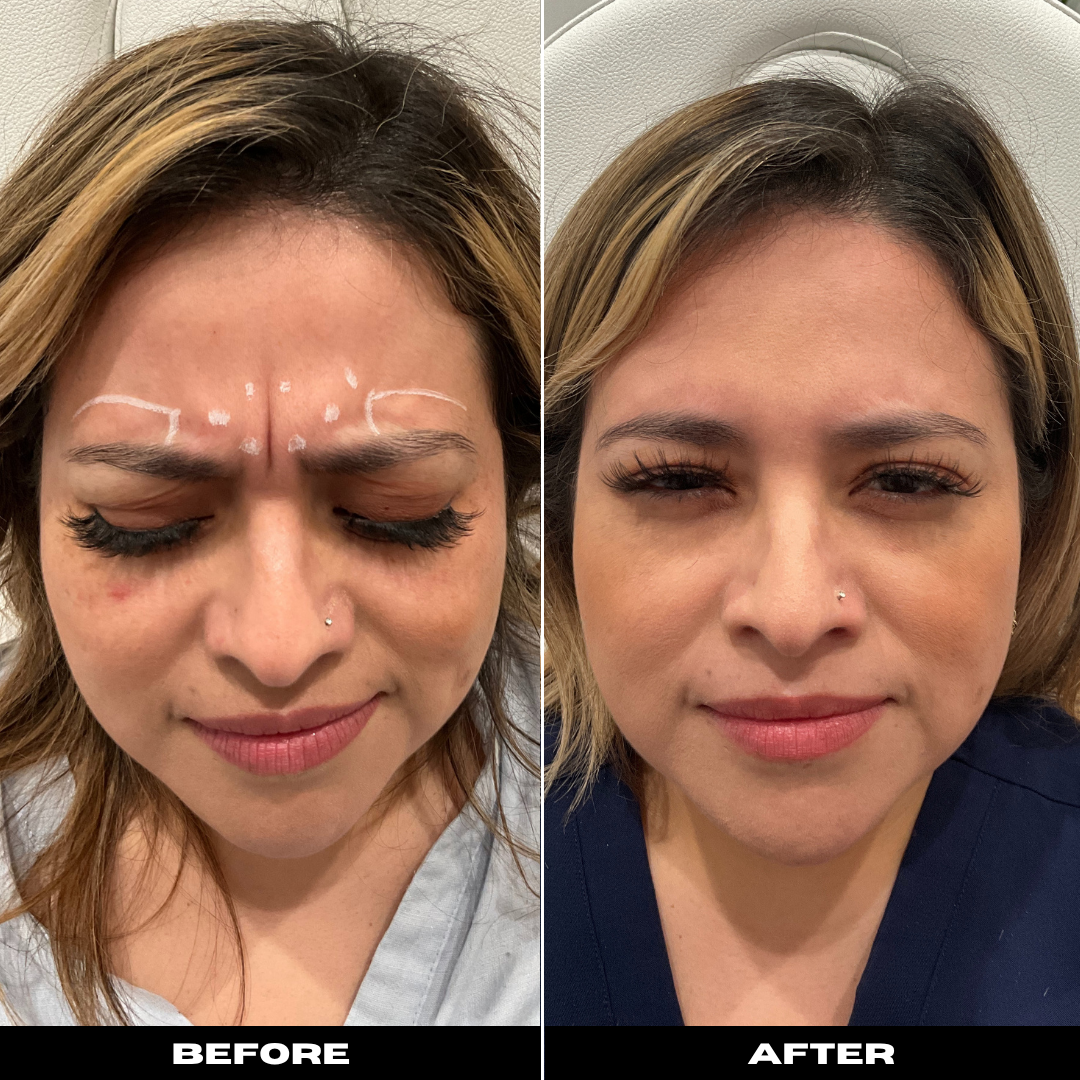 Before and After Image: Tox - front
