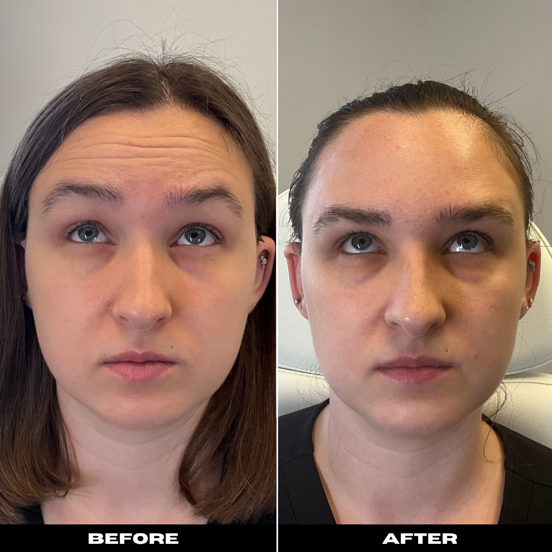 Before and After Image: Tox - front