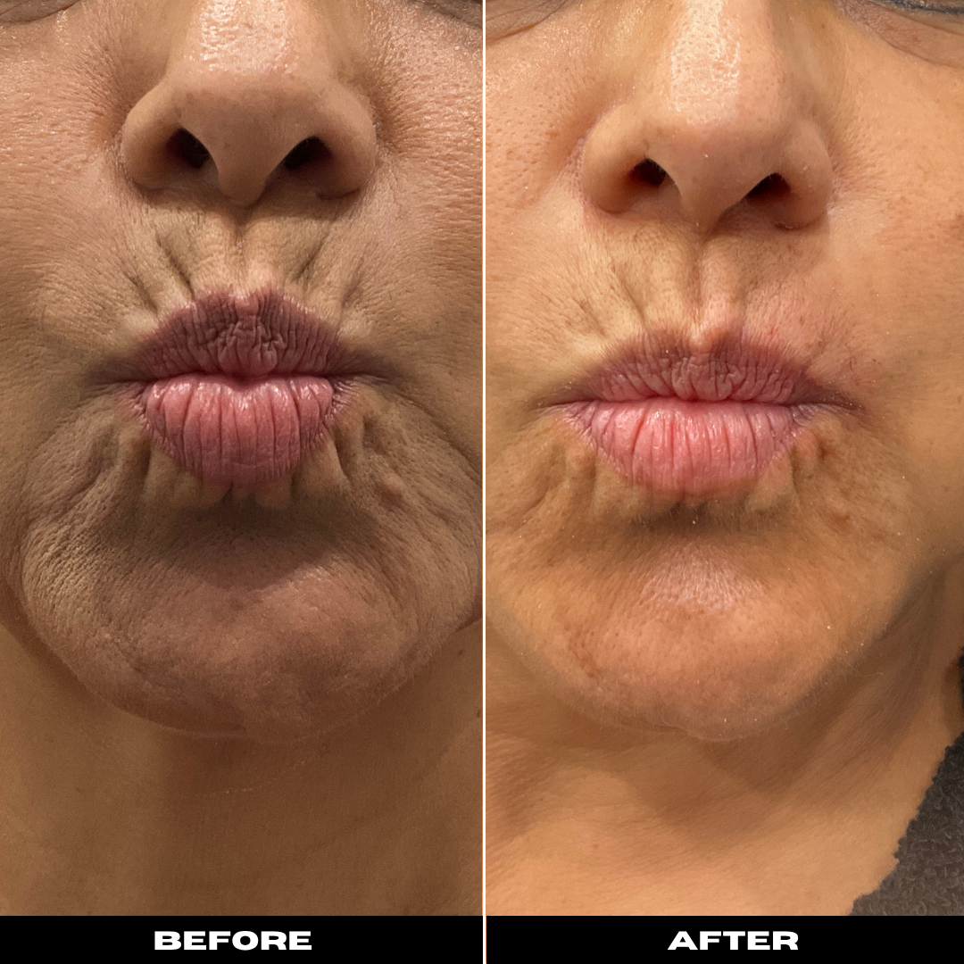 Before and After Image: Tox - front