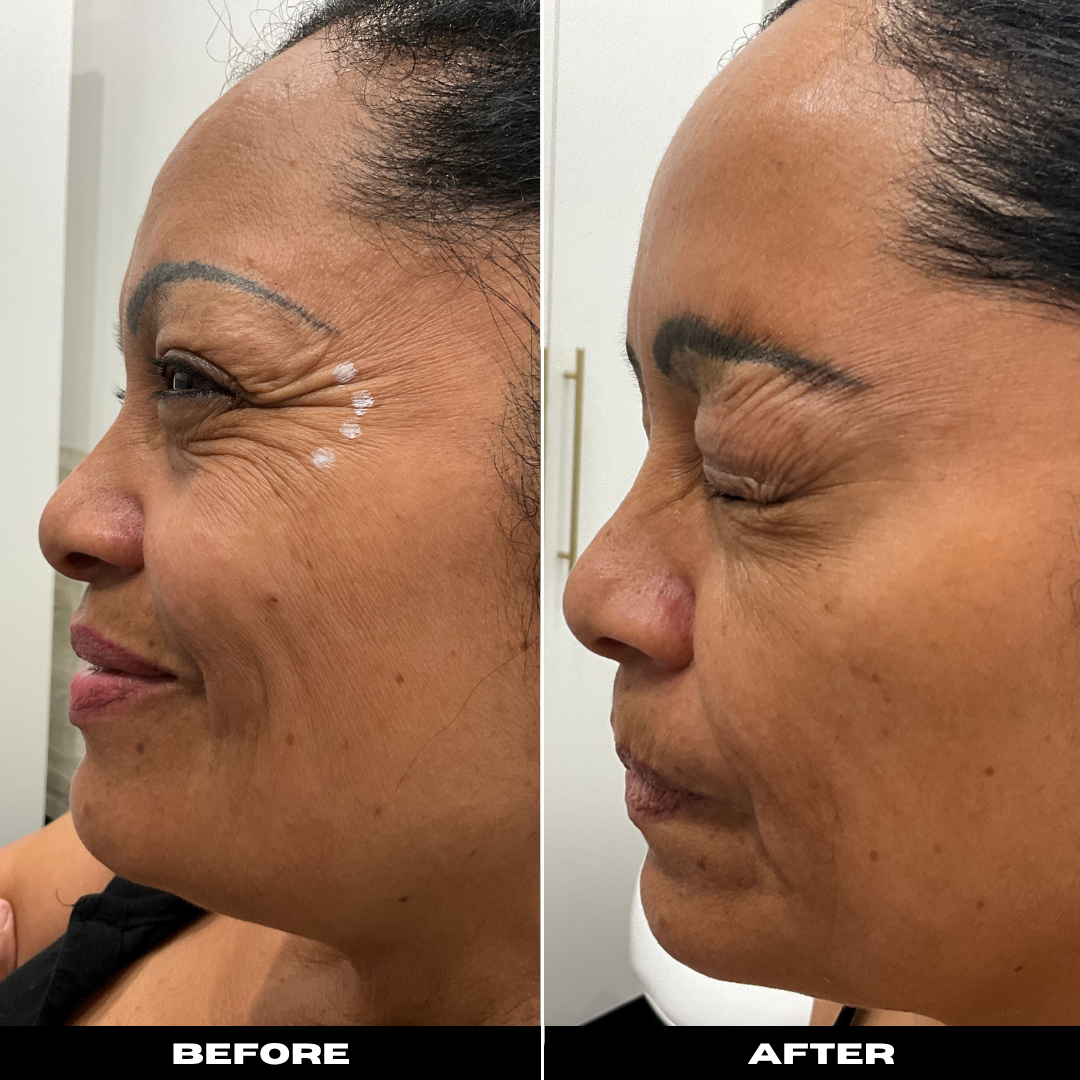 Before and After Image: Tox - left-side