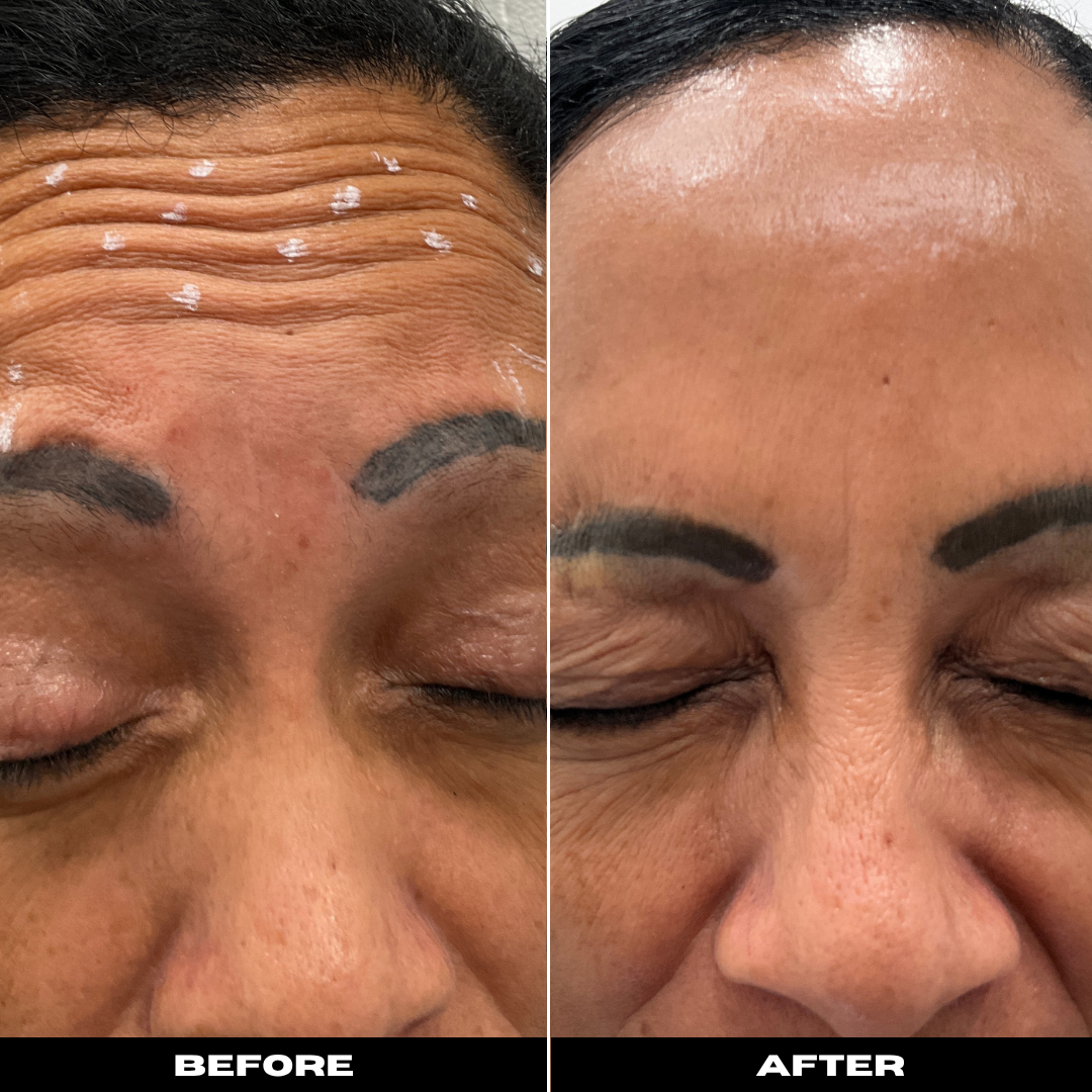Before and After Image: Tox - front