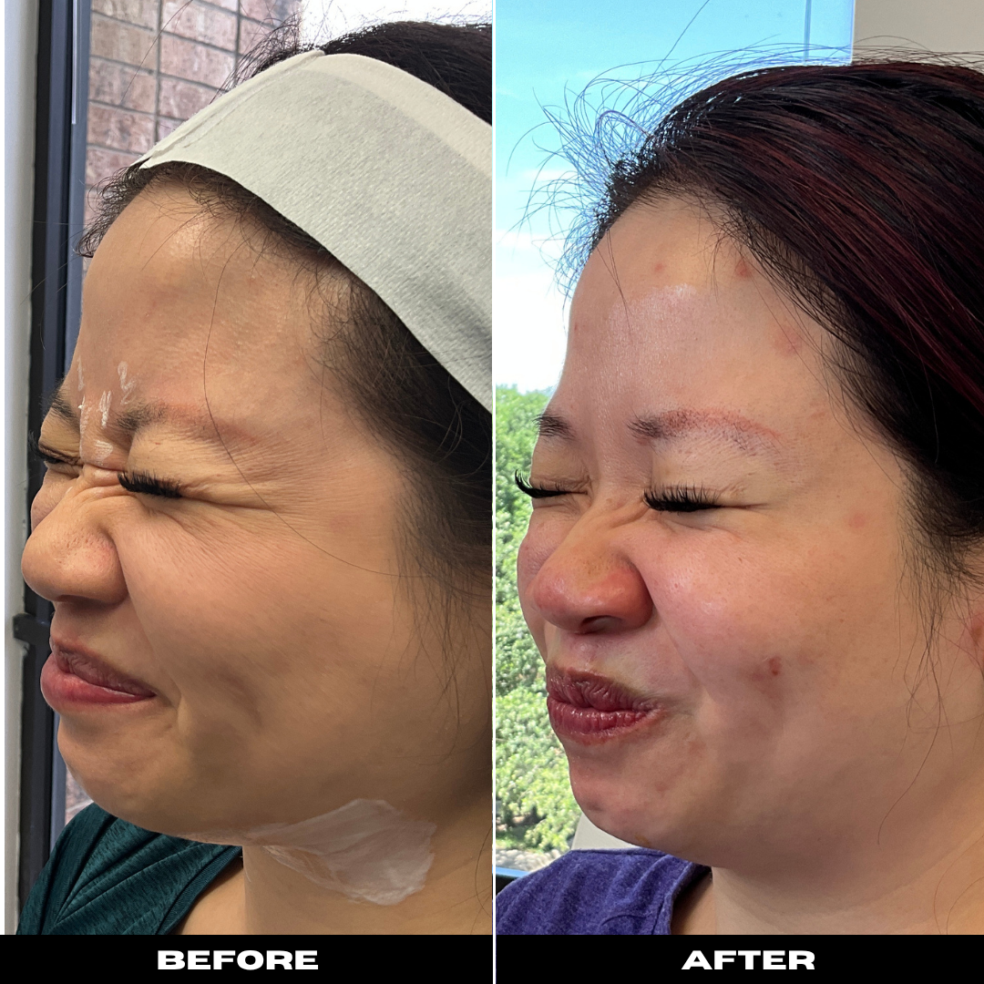 Before and After Image: Tox - left-front-oblique