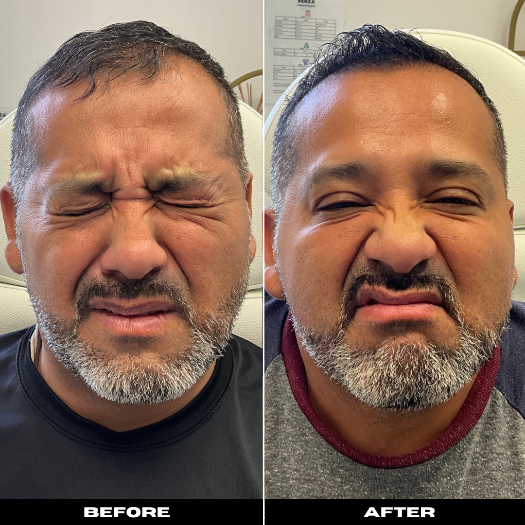 Before and After Image: Tox - front