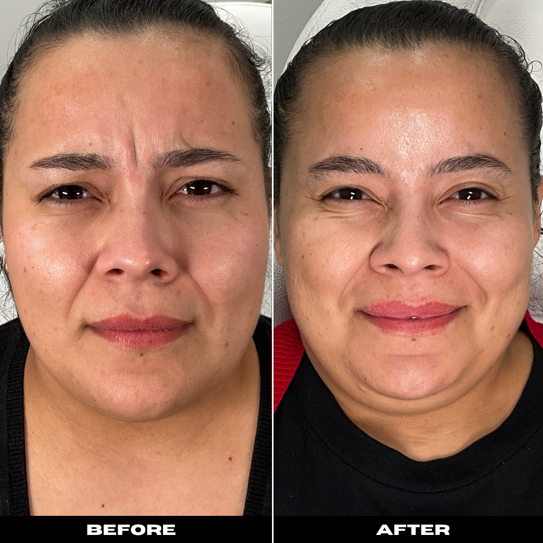 Before and After Image: Tox - front