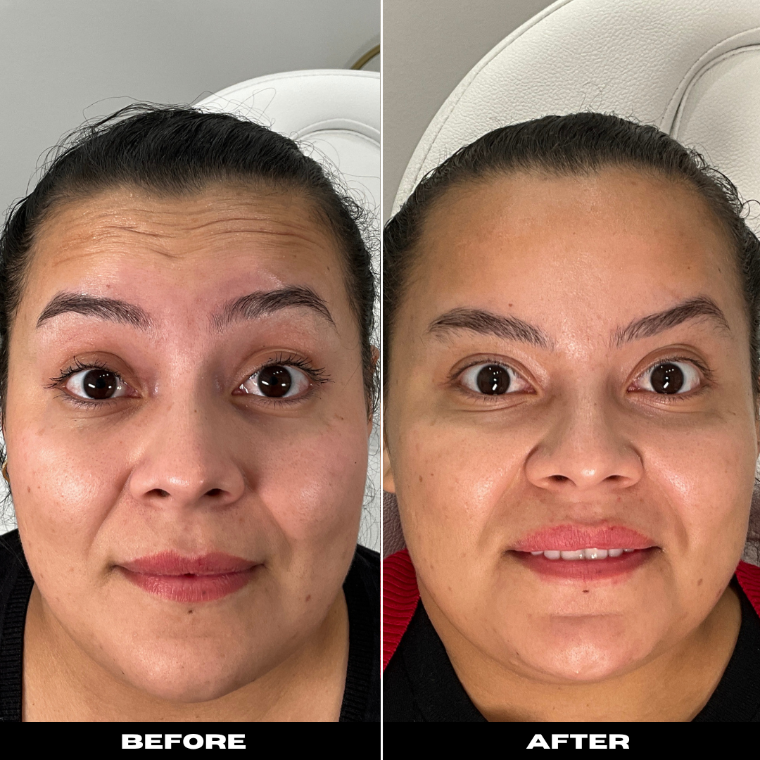 Before and After Image: Tox - front
