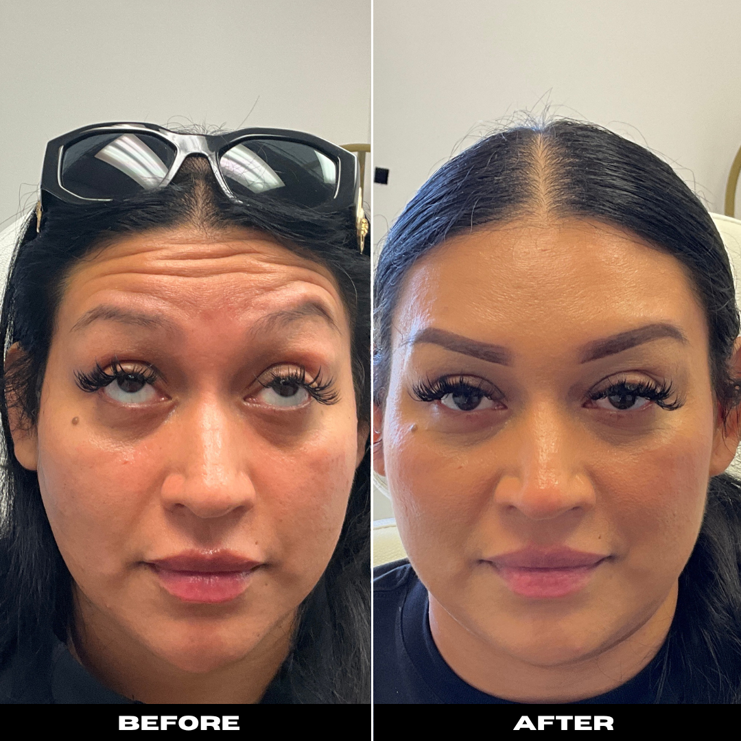 Before and After Image: Tox - front