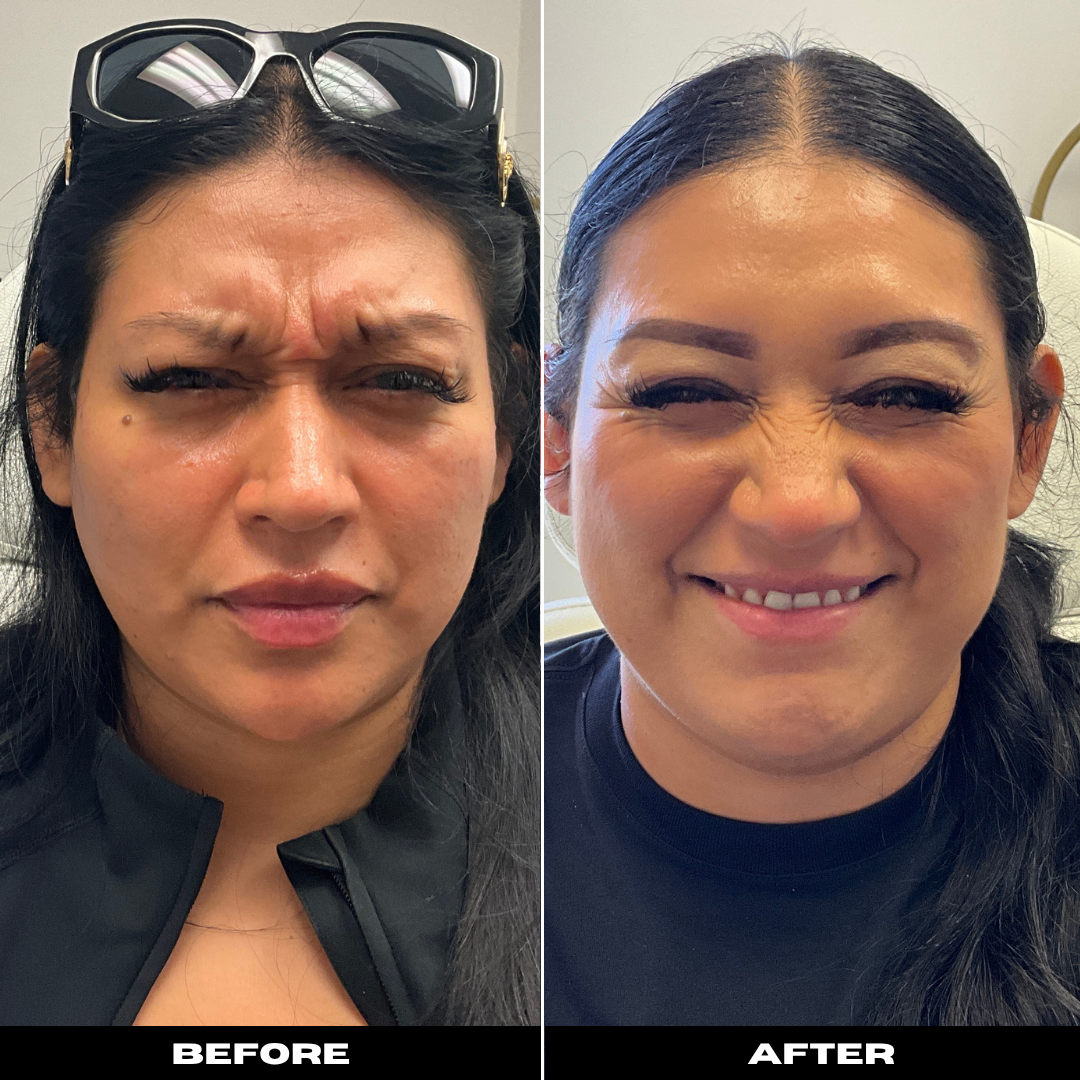 Before and After Image: Tox - front