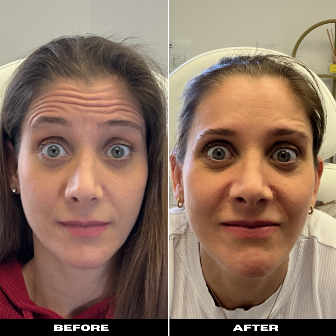 Before and After Image: Tox - front