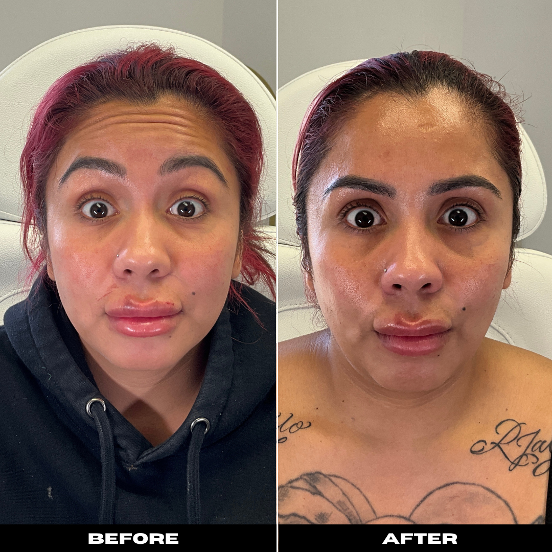 Before and After Image: Tox - front