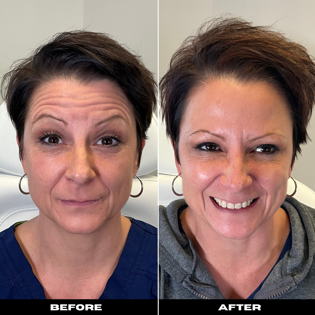 Before and After Image: Tox - front